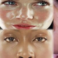 Что влияет на увлажнение кожи